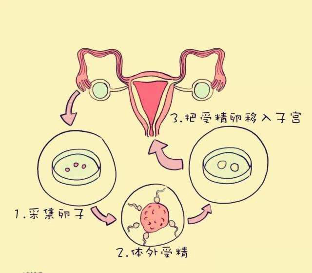 试管婴儿的精子质量要求是什么